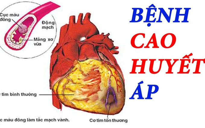 ảnh quả tim.jpg