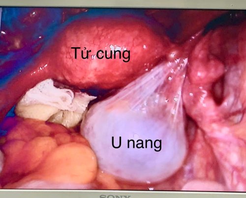 u nang.jpg