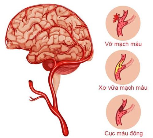 MẠCH MÁU NÃO.jpg