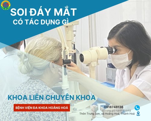SOI ĐÁY MẮT.jpg